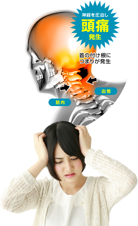 頭痛の原因